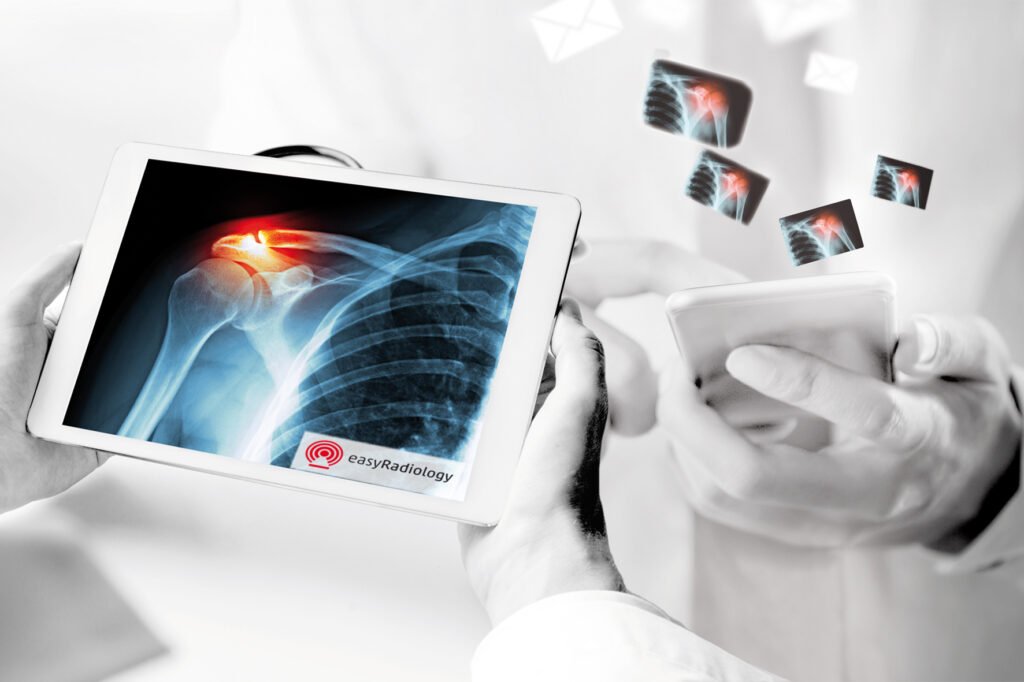 Mit EasyRadiology sind Röntgenbilder in Nu auf Smartphone