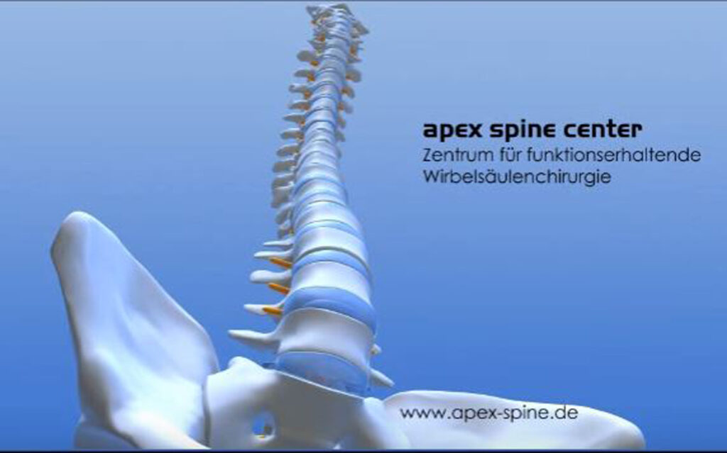 Apex Spine Wirbelsäulencenter