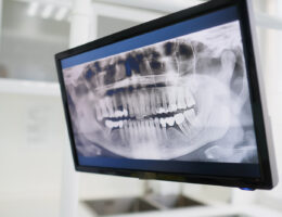 digitale Bildgebungsverfahren in der Zahnmedizin